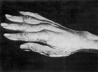 Molde de la mano derecha de Paganini