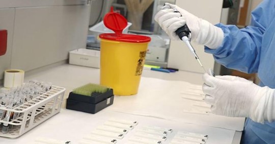 Según informó el ABC el 23 de Abril, El Gobierno pagó los test fallidos al 350 por cien de su precio de mercado.